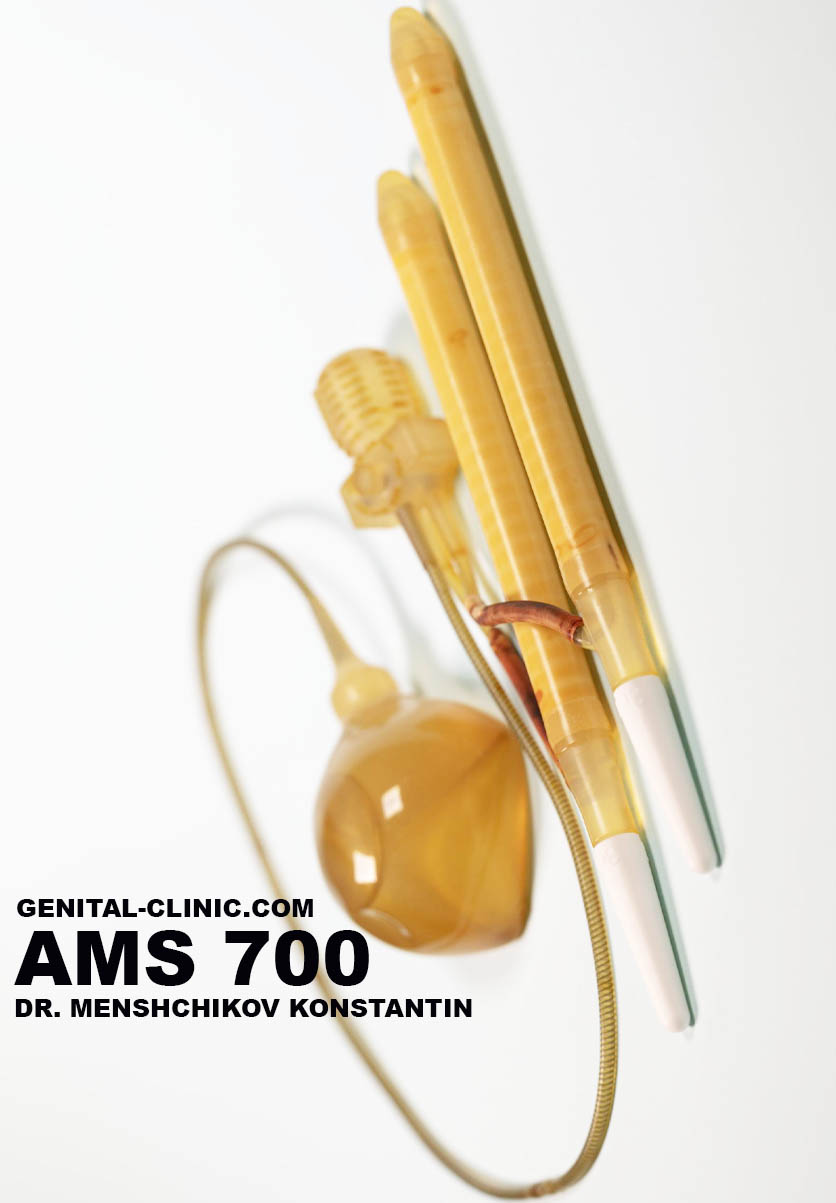 ams 700LGX operation in Turkey